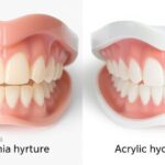 types of hybrid dentures
